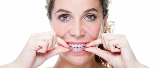 Invisalign Benefits, Surrey Dentist